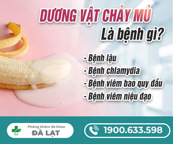 Hình ảnh minh họa